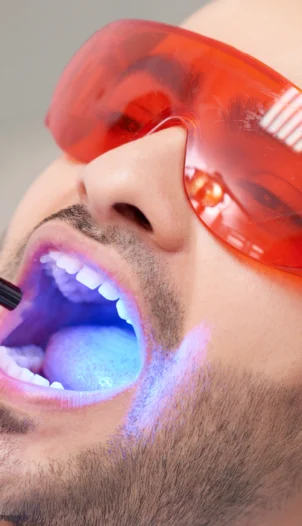 Diş Beyazlatma