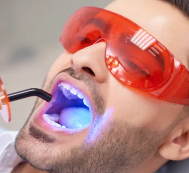 Diş Beyazlatma