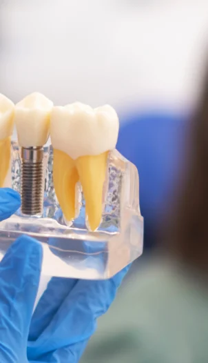 İmplant Tedavisi