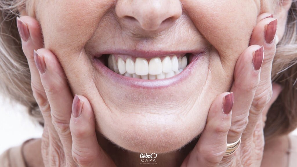 protez diş tedavisi