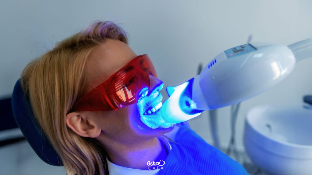 Gebze Diş Beyazlatma