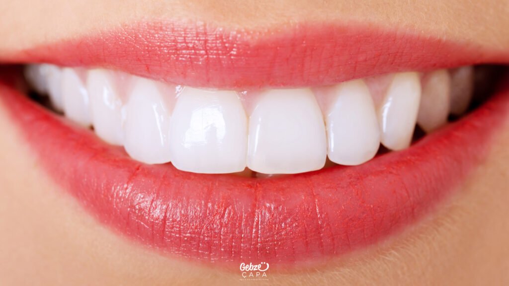 Estetik diş hekimliği