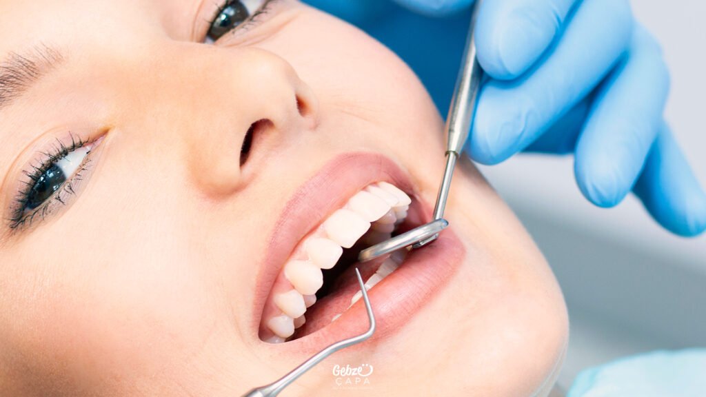 Estetik diş hekimliği