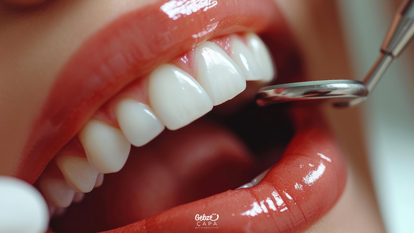 Estetik diş hekimliği